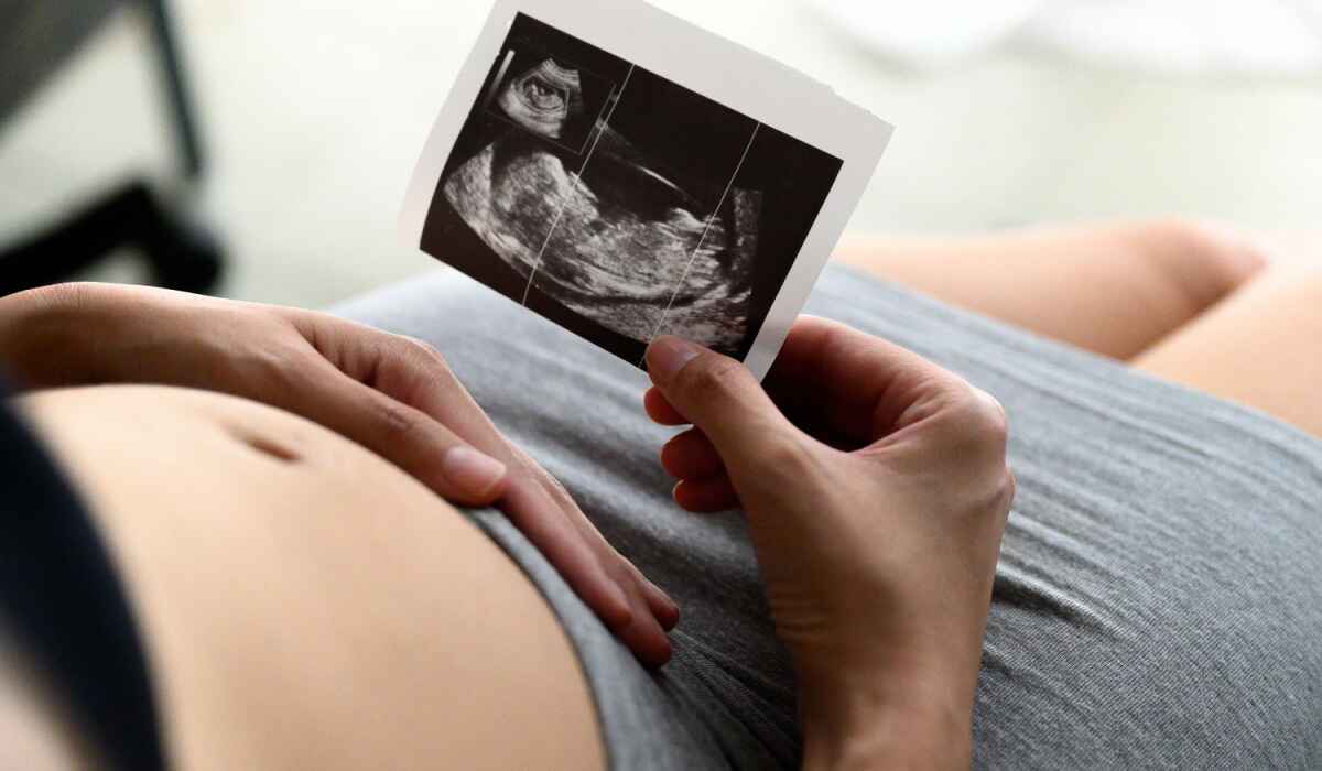 Pregnant woman holding ultrasound picture