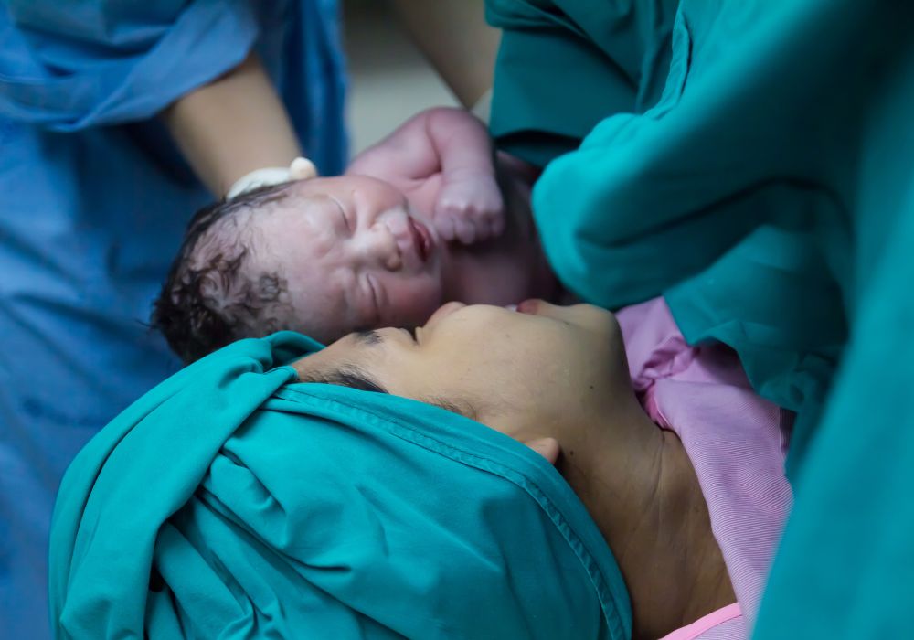 Woman after C section