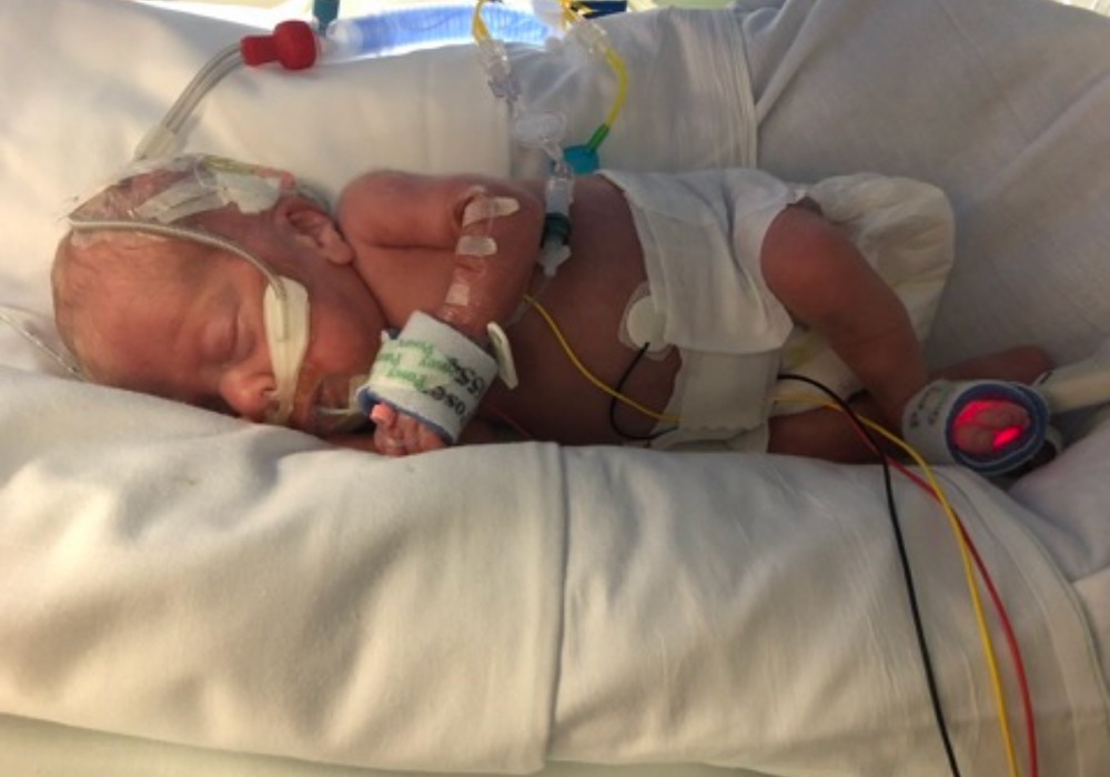 Daisy Mae in an incubator in the NICU. Pic: Supplied