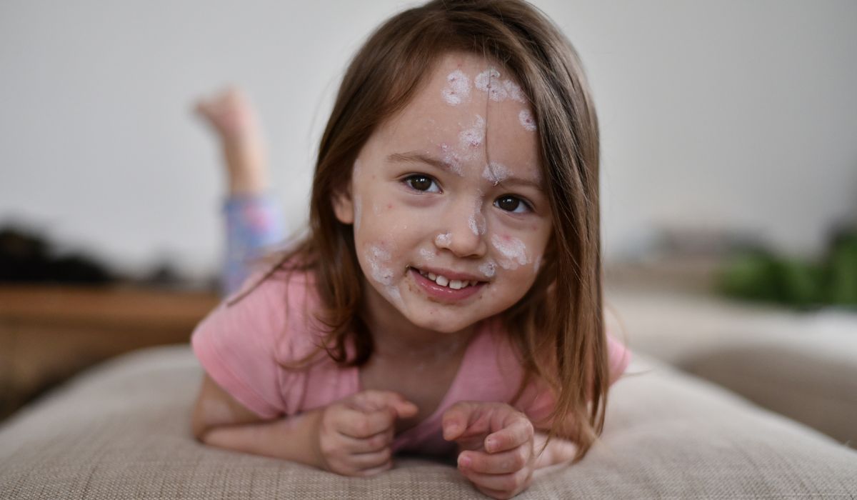 Little girl with chickenpox