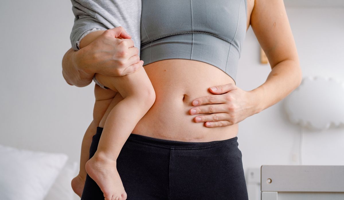 Woman holding her stomach showing her c-section scar as she holds her baby