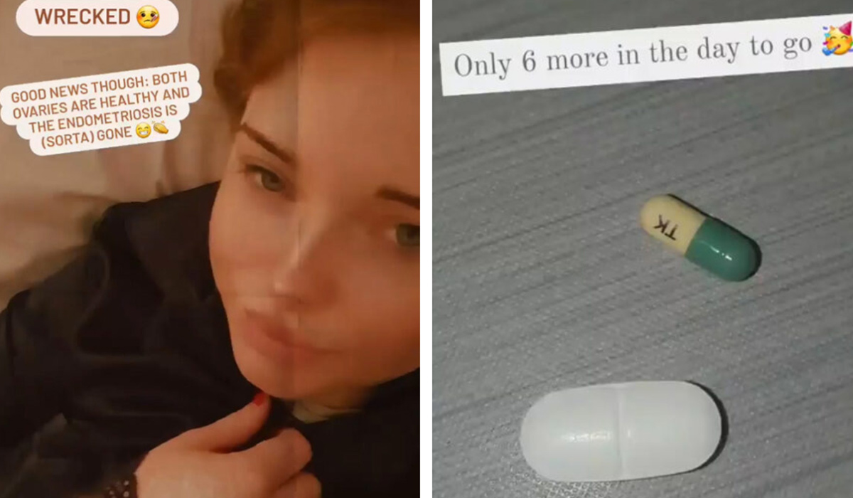 woman after endometriosis surgery