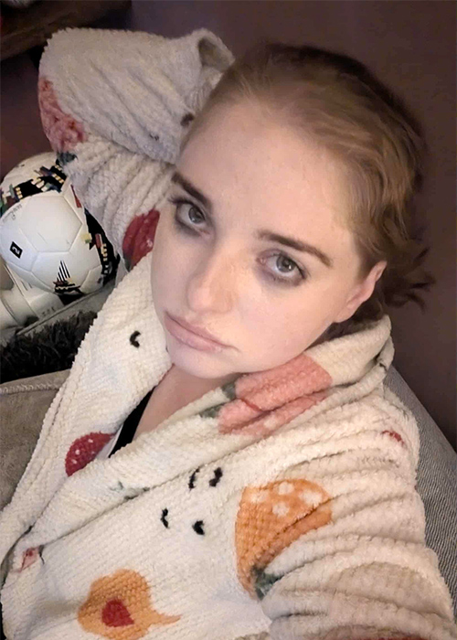 Endometriosis