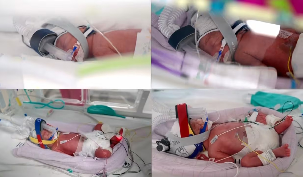 Too tiny for their parents’ arms just yet, identical quadruplets Emily, Harriet, Alexa and Catherine are proof the rarest beginnings can have the brightest futures. Pic: Royal Brisbane and Women’s Hospital/ Seven Network via CNN