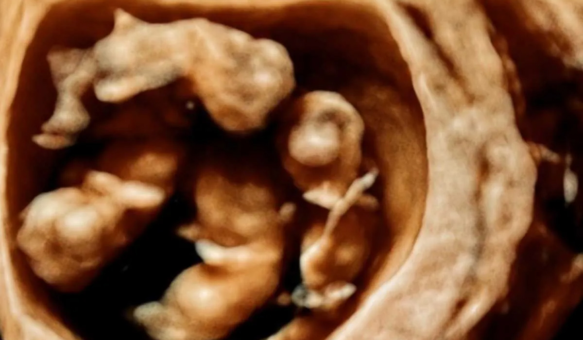 The quadruplets in utero. Pic: GoFundMe